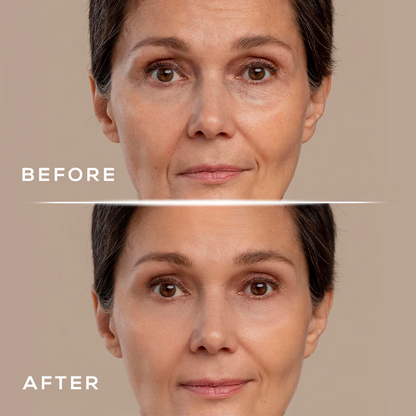 Revya - Under Eye Red Light Therapy