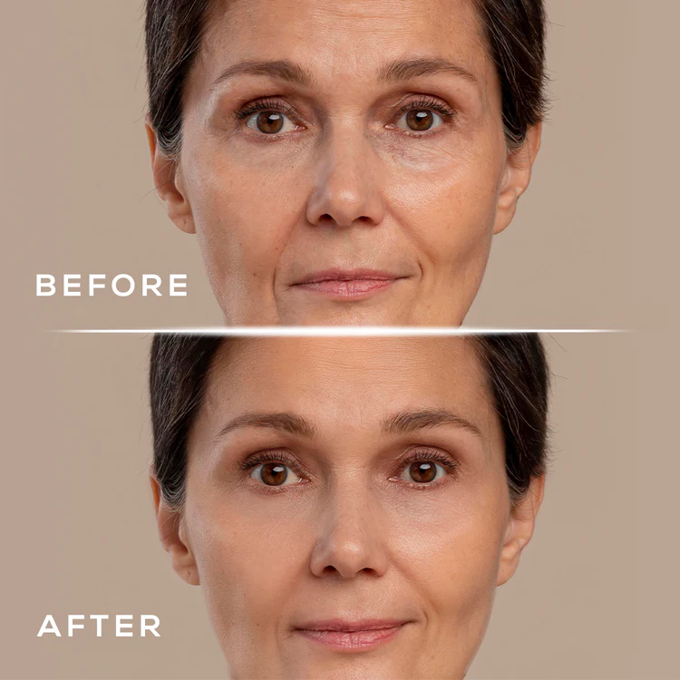 Revya - Under Eye Red Light Therapy