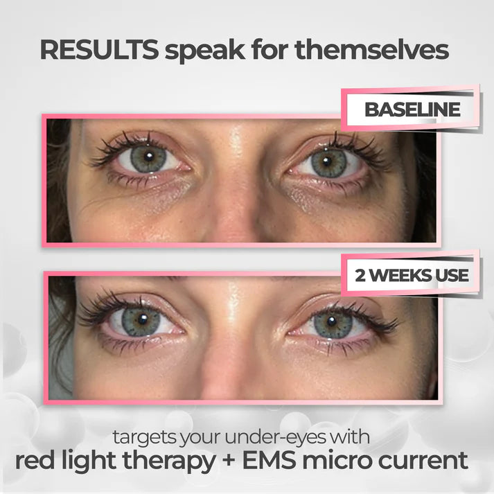 Revya - Under Eye Red Light Therapy